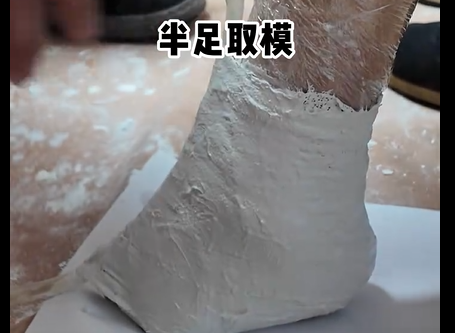 脚掌缺失--假肢定制过程