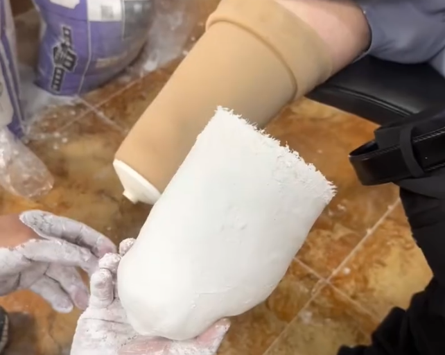 残肢过短？小腿假肢这样选才对