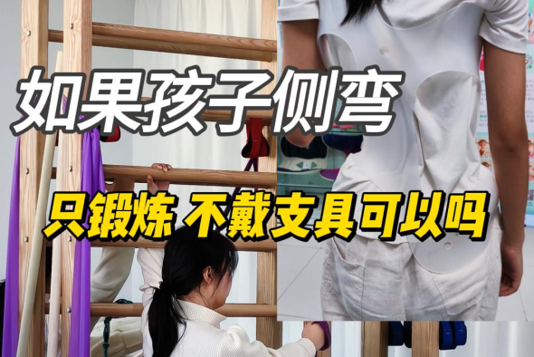 脊柱侧弯孩子不戴支具只锻炼可以吗