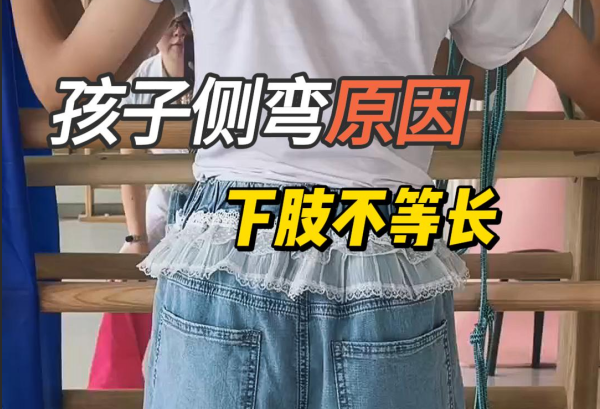 孩子下肢不等长与脊柱侧弯有关系吗
