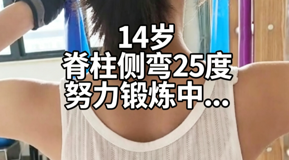 14岁女孩脊柱侧弯训练中