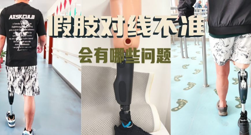假肢对线不准，会有哪些问题